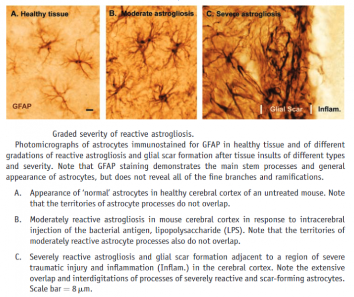 File:Expression of GFAP in reactive astrogliosis.png