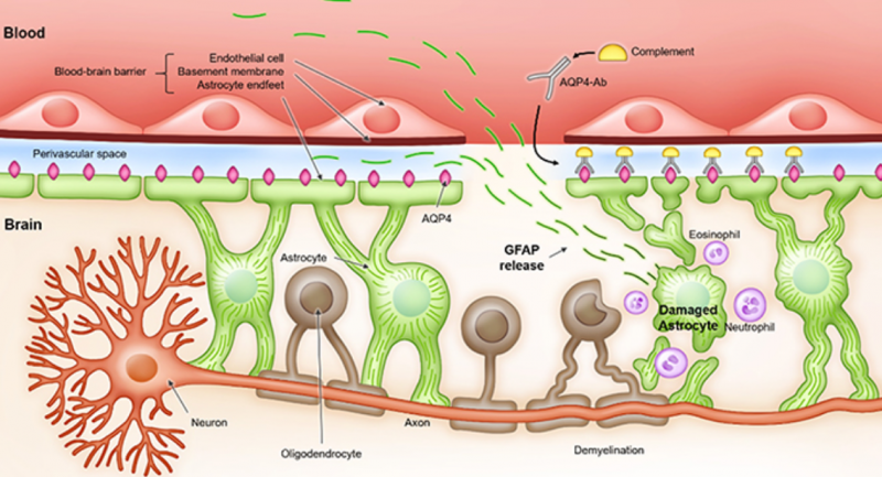 File:Release of GFAP after astrocyte injury.png